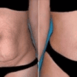 Barriga sequinha