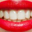 Clarear os dentes naturalmente